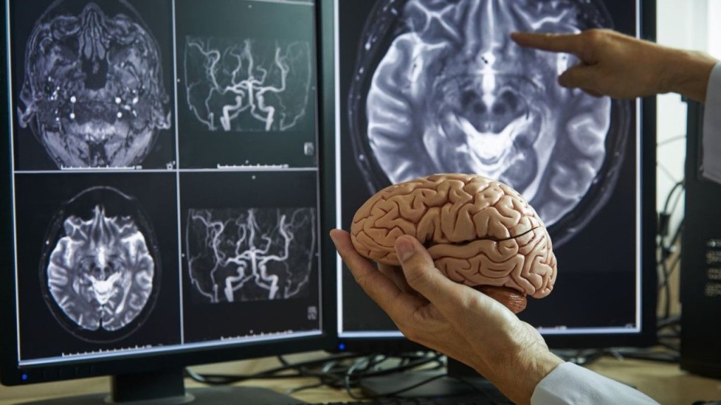 Beyin yaşlanmasını yavaşlatıyor!