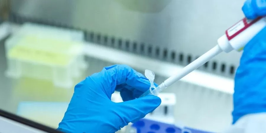 Kocaeli’de test sonucu krizi! 