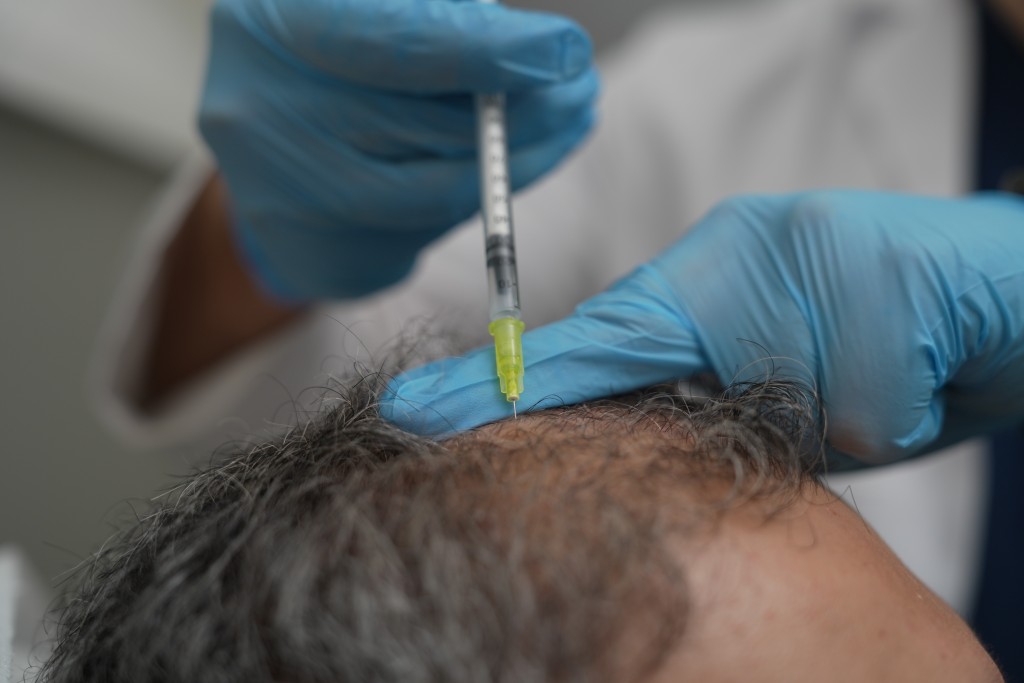 Saçlarınız dökülüyorsa dikkat!