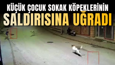 Küçük çocuk sokak köpeklerinin saldırısına uğradı