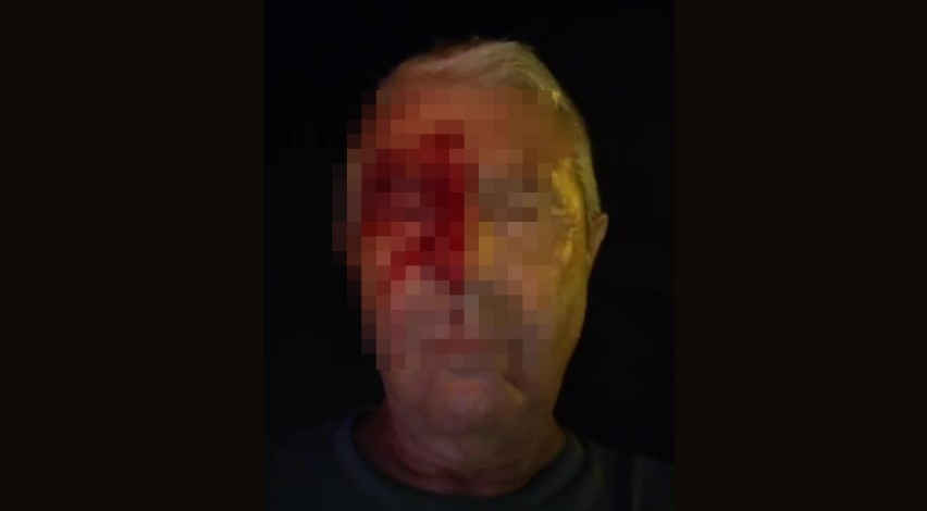 Kocaeli'de darp edilen muhabir kendi haline terk edildi
