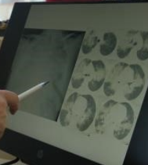 Grip mevsimini erkene çekildi, veliler de hastalandı
