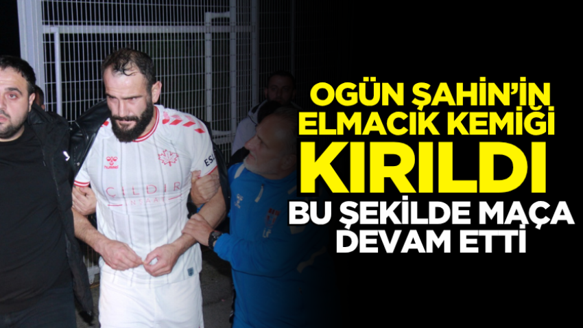 Ogün Şahin’in elmacık kemiği kırıldı, bu şekilde maça devam etti