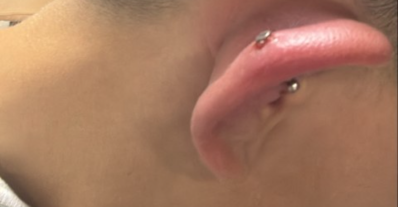 Piercing yaptırdı, hastanelik oldu!